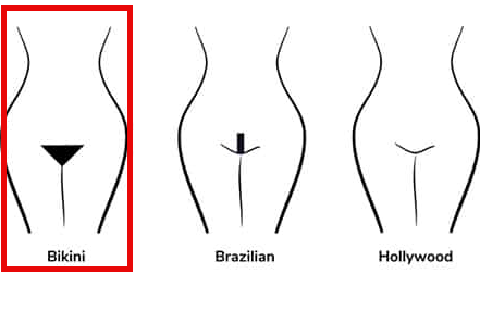 Bikini Line Laser Hair Removal Single Session