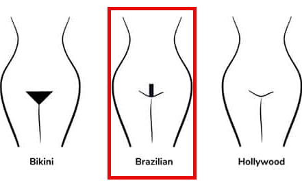 Full Brazilian Laser Hair Removal (Package of 8)