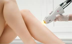 Full Leg Laser Hair Removal (Package of 8)