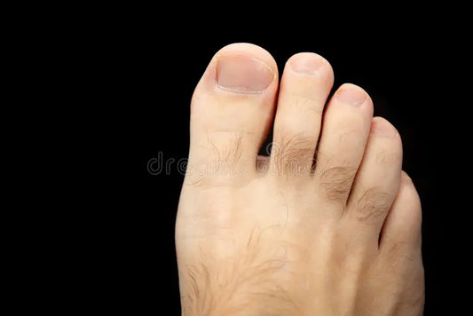 Feet (with toes) Laser Hair Removal (Package of 8)
