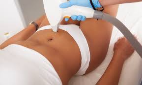 Happy Trail Laser Hair Removal (Package of 8)