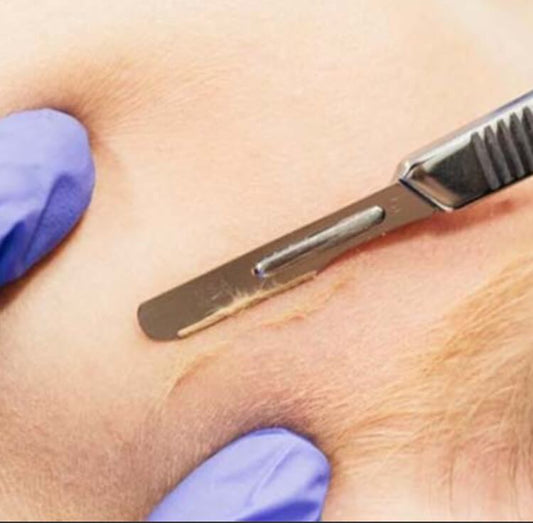 Dermaplane Facial
