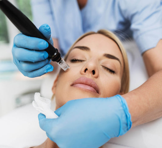 Microneedling Session